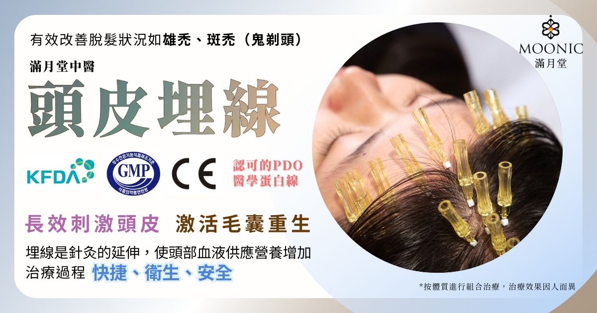 頭皮埋線有用嗎？中醫剖析頭皮穴位埋線生髮療程