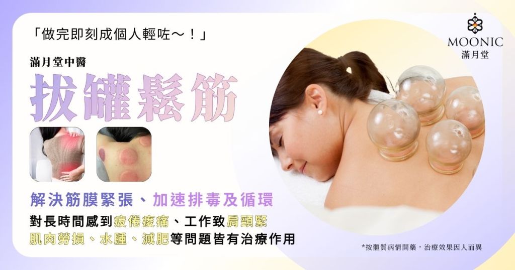 做完即刻成個人輕咗～拔罐對長時間感到疲倦痠痛、工作致肩頸緊 肌肉勞損、水腫、減肥等問題皆有治療作用